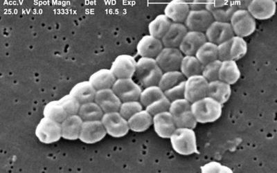 Alerta epidemiológica: brote de una bacteria súper resistente a los antibióticos pone en jaque a los científicos.